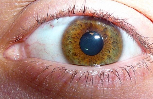 درمان انواع تومور چشمی