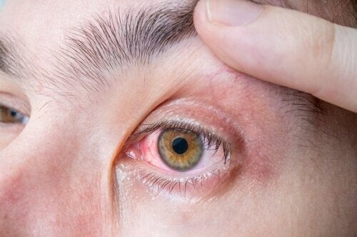 درمان تومور سرطان چشم توسط متخصص تومور کاسه چشم